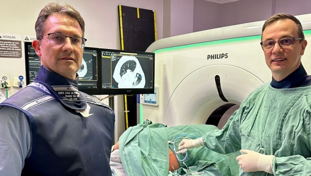 Santa Casa realiza primeira abla&ccedil;&atilde;o de n&oacute;dulo pulmonar no Hospital S&atilde;o Jos&eacute;